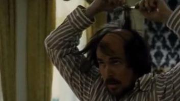 ¿Por qué a ellos les preocupa tanto el pelo?