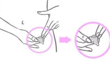 El parche anticonceptivo que promete menos hormonas y más seguridad