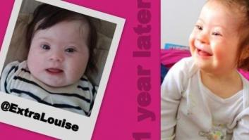 Tener una hija con síndrome de Down me hace soñar con una sociedad más inclusiva