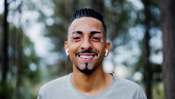 Llega el primer tratamiento a la UE para tratar el vitíligo y es en forma de crema