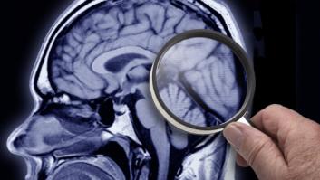 Un estudio encuentra diferencias en el cerebro de hombres y mujeres en ciertos países