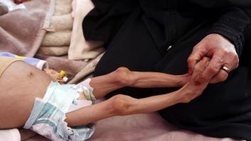 Los objetivos de la ONU fracasan: el hambre sube por cuarto año hasta los 258 millones de personas