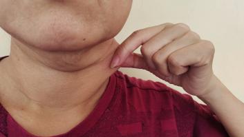 Los alimentos con la vitamina idónea para reducir papada y cachetes