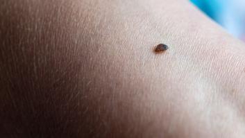 Marruecos evita el caso de España y se blinda ante las chinches francesas