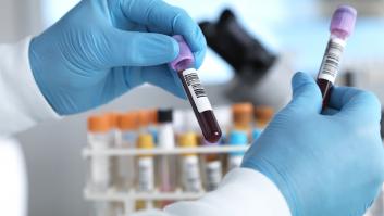 La curiosa condición que puede provocar que tu sangre se vuelva verde