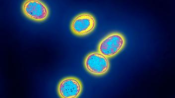 La brucelosis llega a Madrid en estos animales