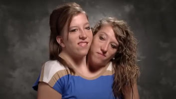 El aspecto de la vida de las siamesas Abby y Brittany que causa indignación: para muchos, injusto