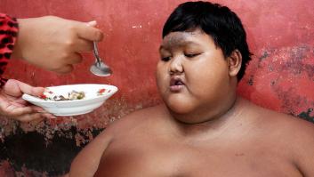 El niño de 200 kilos esquiva la muerte y da un giro casi imposible a su vida