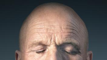 Desvelan los tres factores que convierten a España en el país líder de calvos del mundo