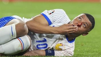 Kylian Mbappé se va con la nariz rota del debut de Francia en la Eurocopa 2024