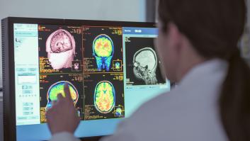 Un controvertido estudio echa por tierra todo lo que se sabía sobre las neuronas