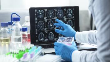 Piden cumplir la 'dieta mental' mediterránea desde los 40 años para levantar un muro a la demencia