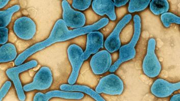 El virus de Marburgo enciende las alarmas de la OMS: piden prestar atención a estos síntomas