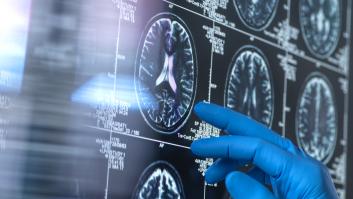 La ciencia desentraña el mapa que puede ayudar al diagnóstico precoz del Alzheimer o el Párkinson