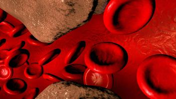 Una actualización médica bautiza a la dieta como el falso culpable del colesterol