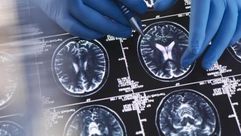 Este hospital tiene un escáner de resonancia magnética de juguete porque le ayuda a ahorrar 170.000 euros