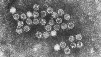 España documenta los primeros casos en niños de un enterovirus raro detectado en Europa