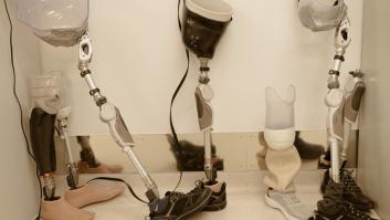 Promesas vacías para los soldados amputados de Putin