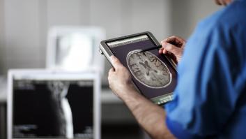 Un neurocirujano resuelve el enigma detrás del porqué se nos quedan los nombres en la punta de la lengua