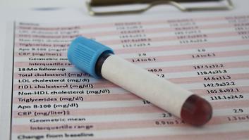 En EEUU ensalzan el fármaco que con una dosis acaba con el 94% del colesterol que no se detecta en los análisis