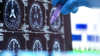 Un neurólogo desmonta las bondades de los frutos secos para la enfermedad que sufren 5 millones de españoles