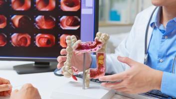 El aumento del cáncer colorrectal en jóvenes podría deberse a una infección en la infancia