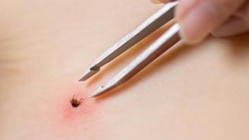 Protege a tu familia: el kit contra garrapatas de Amazon que todos están comprando y tú necesitas ahora mismo