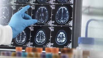 Un estudio señala que las personas con demencia pueden recuperar la memoria