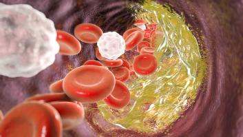 Una grasa saludable, la fibra ideal y el muro a estos carbohidratos: 3 reglas de oro para contener la subida del colesterol