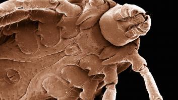 Saca su sábana de las garrapatas y la arrastra por la carretera para saber si su pueblo está infectado de la horrible plaga