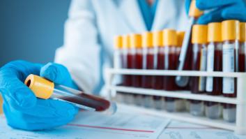 Un cardiólogo advierte a los españoles sobre la temprana edad a la que deben empezar a mirar el colesterol con lupa