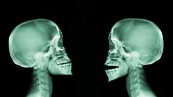 Científicos afirman que curanderos extirparon tumores cancerígenos de la cabeza de un paciente hace más de 4000 años