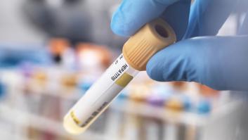 Salud investiga un posible brote de hepatitis A en Jumilla (Murcia)