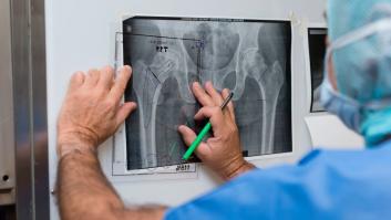 Le hacen radiografías de cadera en dos hospitales distintos: "Tienes dos caderas y debería tratarlas a la vez"