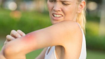 Piensa que es solo una picadura de mosquito hasta que va a la farmacia: "Hiciste bien en venir, podrías haber muerto"