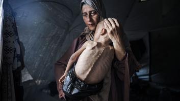 Al menos ocho personas, incluidos dos bebés, mueren por hambre y desnutrición en Gaza en las últimas 24 horas