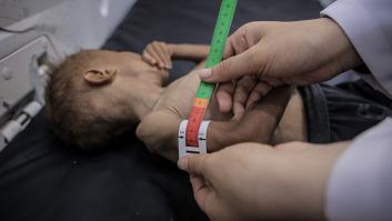 El Gobierno prepara un avión medicalizado para transportar a 13 niños gazatíes a España para ser tratados