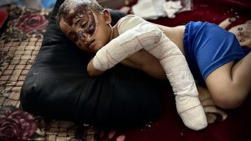 "Inusualmente graves": el informe sanitario que revela la brutalidad de las heridas de los gazatíes