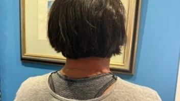 Una víctima de violencia machista recoge firmas para que Igualdad cambie las pulseras: "Los agresores saben que no funcionan bien y lo aprovechan"