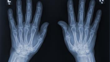 Muchos se habrán preguntado por qué el pulgar tiene dos huesos y el resto de dedos tres: se debe a una cuestión de adaptación