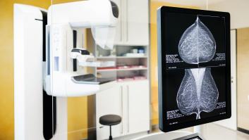 Más de 90.000 mujeres tampoco fueron avisadas para las pruebas de mamografías en los hospitales de Valencia