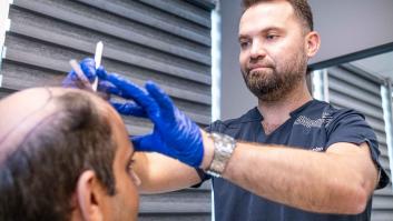 Top 10+ de médicos de injerto capilar en Turquía 2025