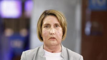 El Hospital Vall d'Hebron realiza con éxito el primer trasplante de cara gracias a una donante que recibió la eutanasia