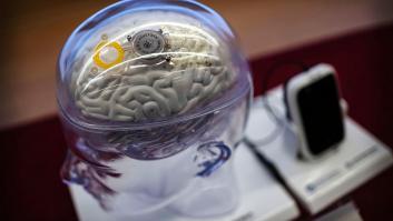 Ni Neuralink ni Silicon Valley: China acaba de aprobar el primer implante cerebral comercial del mundo