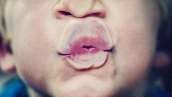 Un farmacéutico avisa del peligro al que nos exponemos cuando nos dan dos besos en la cara