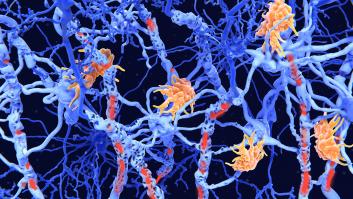 Una investigadora española firma en Nature un avance contra el Alzheimer, el Parkinson y la esclerosis múltiple: la inflamación cerebral es también el primer paso de la reparación