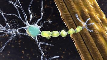 Un paciente paralizado por ELA vuelve a hablar con su familia gracias a un implante cerebral