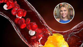 Carlota Serra, farmacéutica: "Un colesterol total alto no siempre significa que tengas más riesgo"