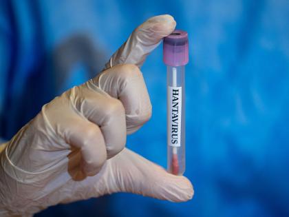 ANKARA, TURKIYE - MAY 06: In this photo illustration Hantavirus samples are seen in Ankara, Turkiye on May 06,, 2026. (Photo by Arman Onal/Anadolu via Getty Images)