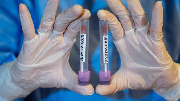 Muestras de hantavirus en Turquía